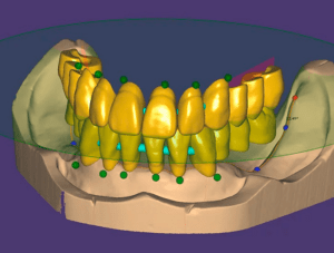 full-denture-module_2